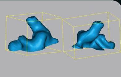 BlackBox3D EarFigure 3D Scanner (İşitme Cihazı & Özel Kulaklık Tasarımında)